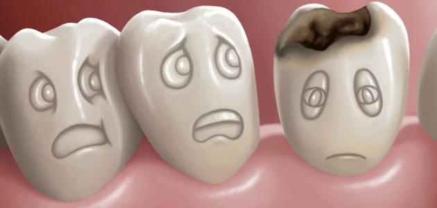 علاج تسوس الاسنان , الاسباب والوقايه من تلف الاسنان
