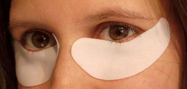 علاج الهالات السوداء , اسباب ظهور السواد تحت العين وعلاجة