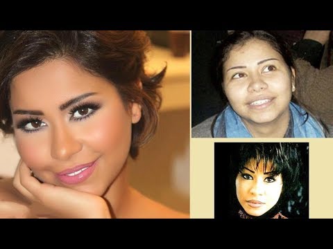 شيرين قبل عمليات التجميل- الفنانه شيرين قبل التجميل 12196 3