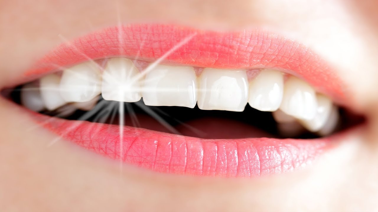 معلومات عن الاسنان - معلومات مفيداء عن الاسنان الاسنان- عن- معلومات- مفيداء 11851
