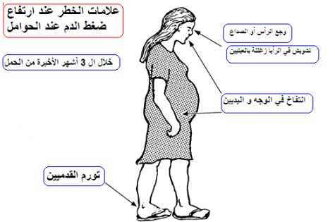 اعراض ارتفاع الضغط للحامل - علامات لازم معرفتها جيدا لو كنتى حامل ارتفاع- اعراض- الضغط- جيدا- حامل- علامات- كنتى- لازم- للحامل- لو- معرفتها 12445 3