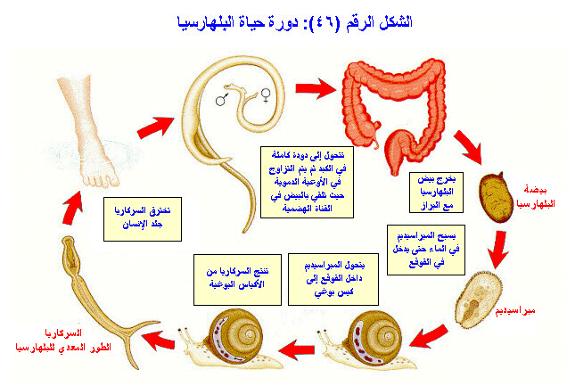 مرض البلهارسيا - تعرف على البلهاريسيا بالتفصيل 1390