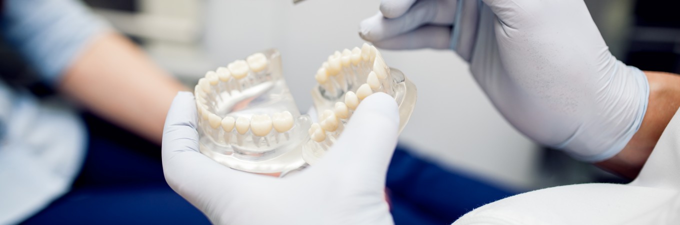 طقم اسنان - صورتركيبات صناعيه للاسنان اسنان- صناعيه- صورتركيبات- طقم- للاسنان 1245 5