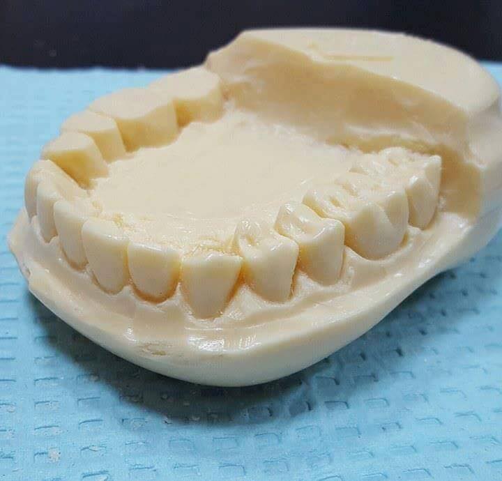 طقم اسنان - صورتركيبات صناعيه للاسنان اسنان- صناعيه- صورتركيبات- طقم- للاسنان 1245 12
