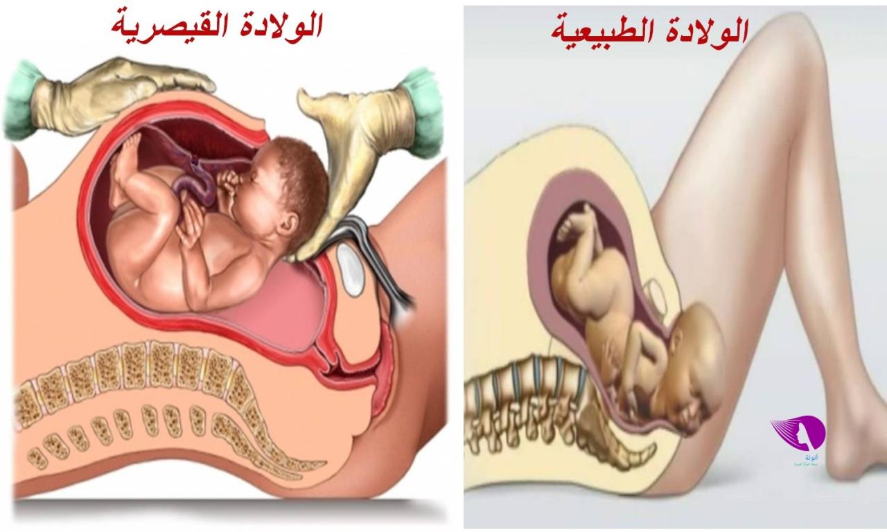 الولادة الطبيعية بالصور لحظة بلحظة 1498 2