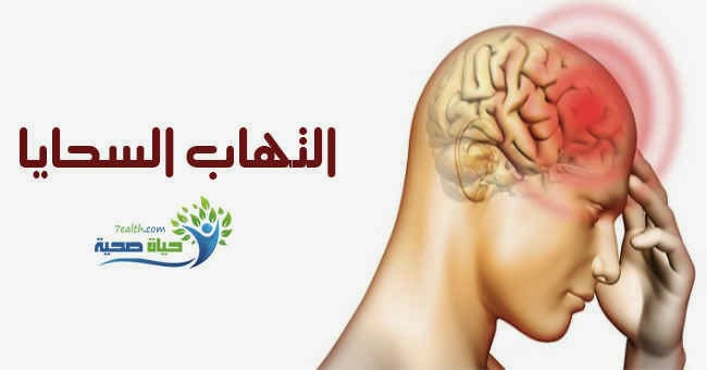 مرض السحايا - اعرف ما هو مرض السحايا 5779 1