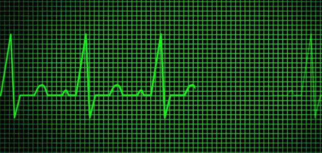 اهم الأمراض التي تسرع نبضات القلب-تسارع نبضات القلب 1979 2