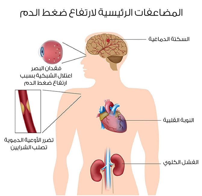 مرض الضغط , معلومات عن مرض ضغط الدم