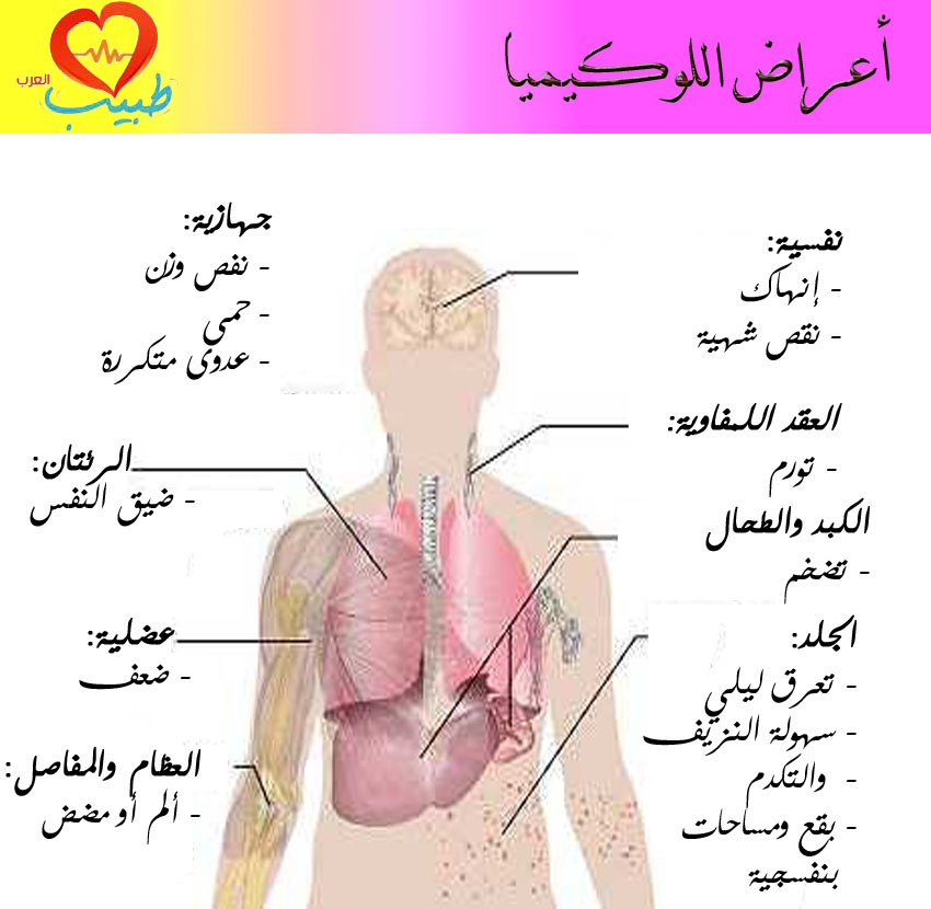 اعراض سرطان الدم